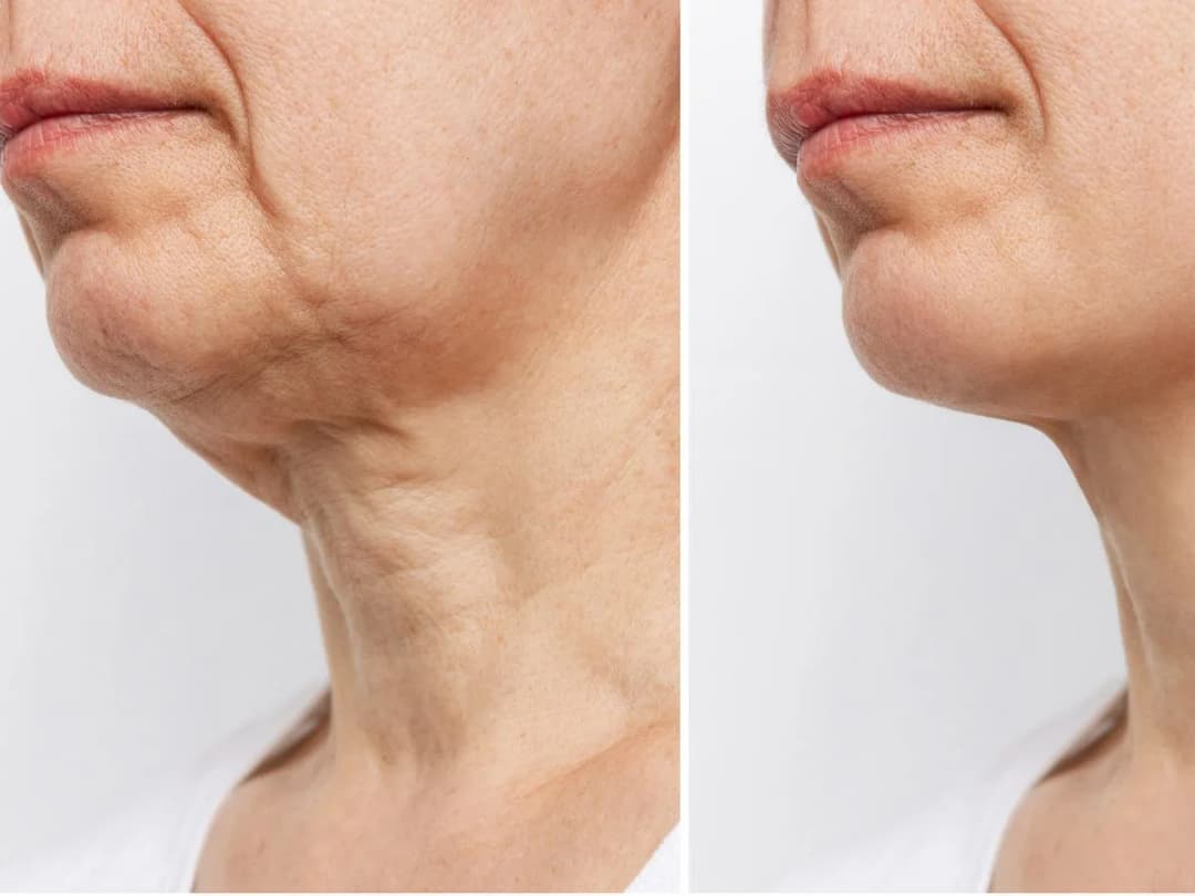 Czy joga twarzy działa: Opinie ekspertów i wyniki badań naukowych